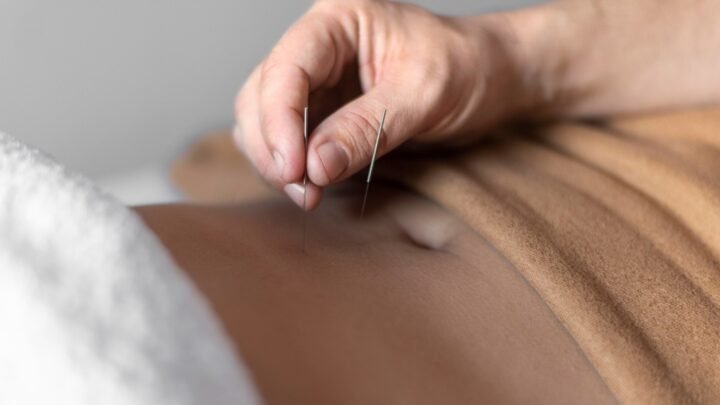 Bantu Kehamilan dengan Akupunktur, Bethsaida Hospital Hadirkan Klinik Khusus