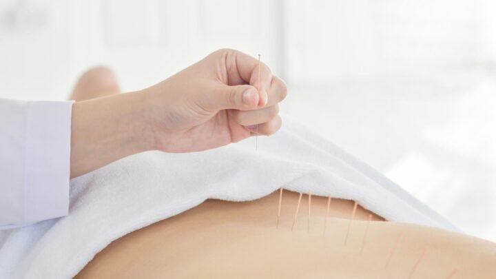 Klinik Akupuntur Bethsaida Hospital Serang Wujudkan Pejuang Dua Garis