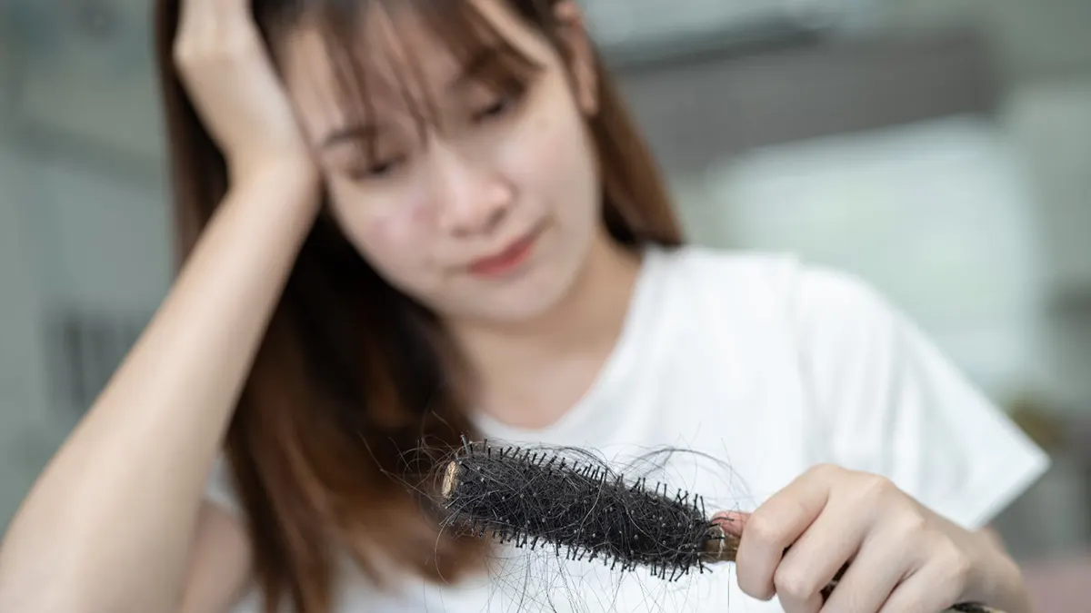 Rambut Rontok