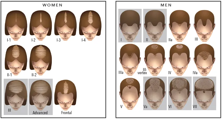rambut rontok